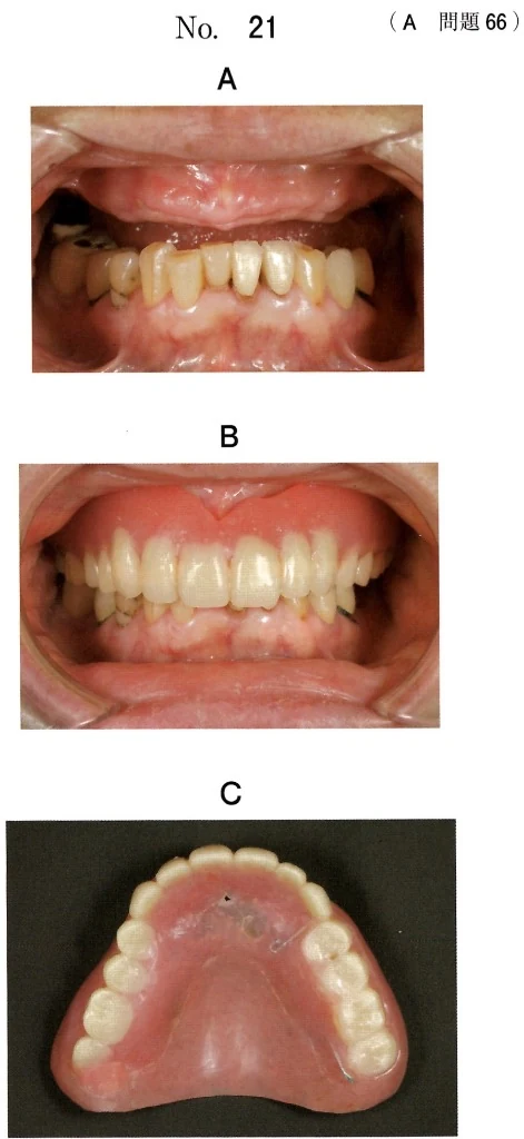 119A66の別冊図1