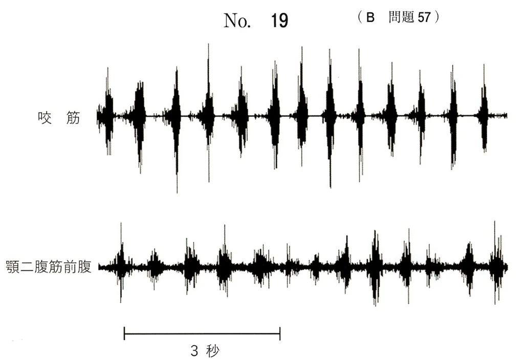 119B57の別冊図1