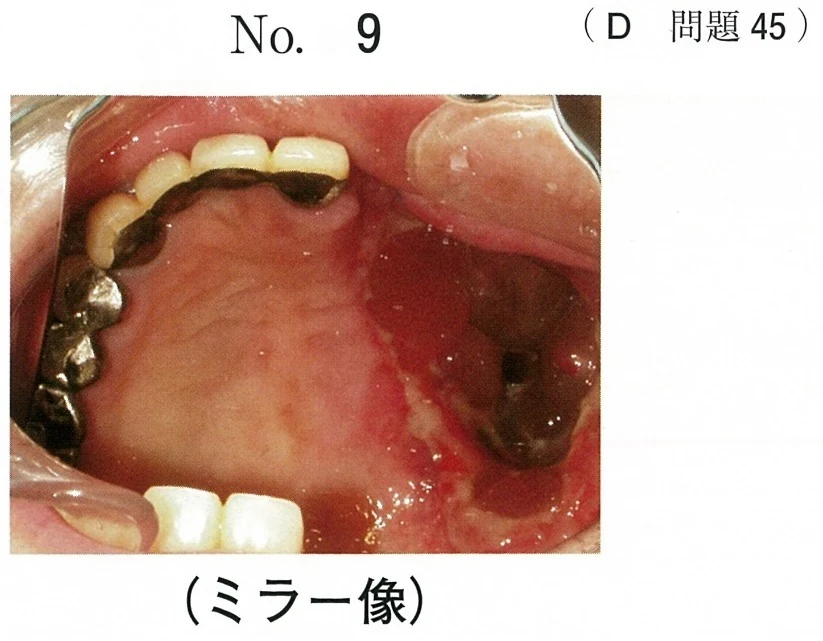 119D45の別冊図1