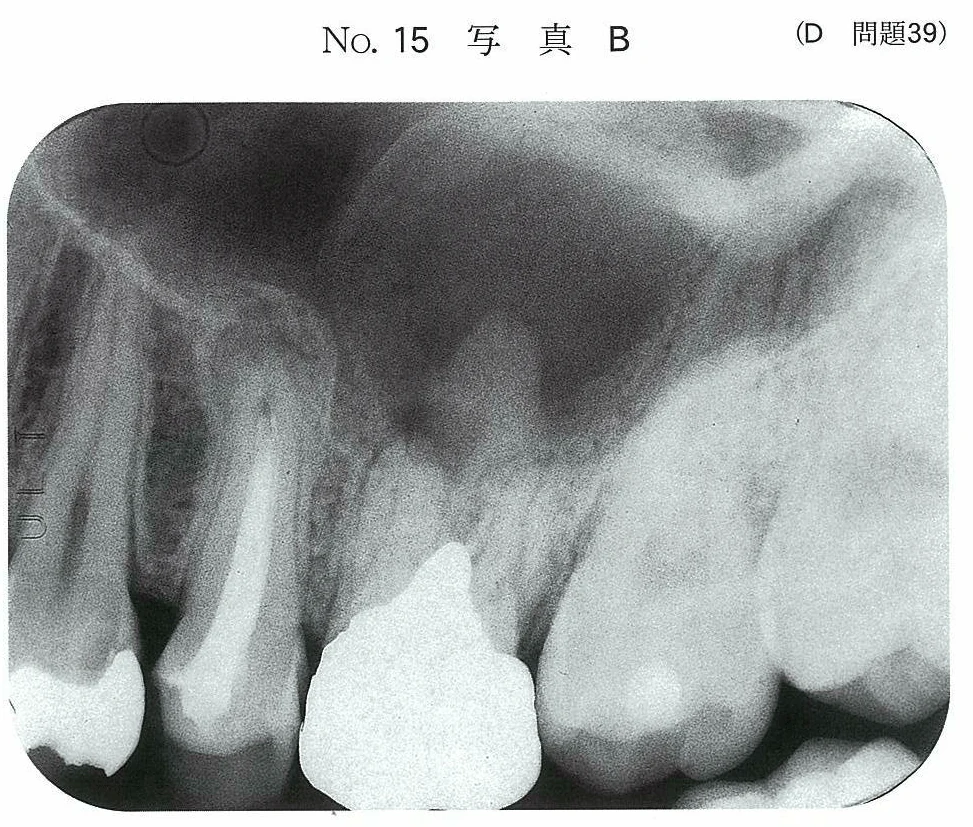 95D39の別冊図2