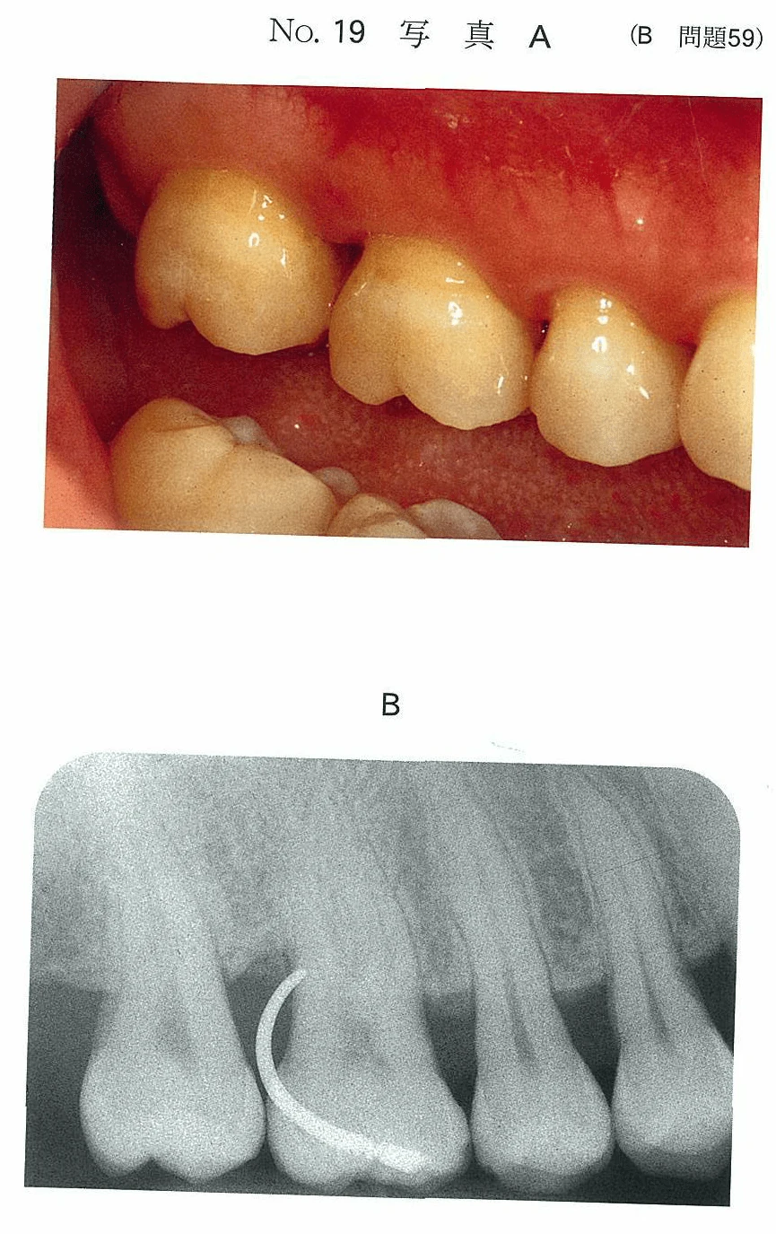 97B59の別冊図1