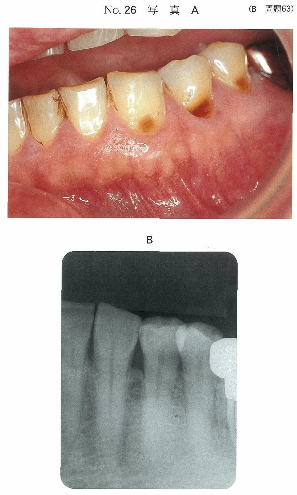 98B63の別冊図1