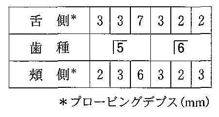 99B66の別冊図1